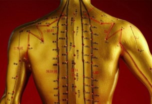 ACUPUNCTURE<br></br>